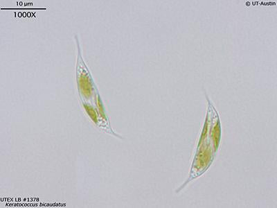 UTEX LB 1378 Keratococcus bicaudatus | UTEX Culture Collection of Algae