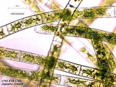UTEX LB 1740 Zygnema extenue | UTEX Culture Collection of Algae