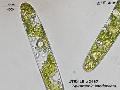 UTEX LB 2467 Spirotaenia condensata | UTEX Culture Collection of Algae