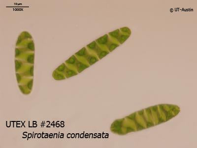 UTEX LB 2468 Spirotaenia condensata | UTEX Culture Collection of Algae