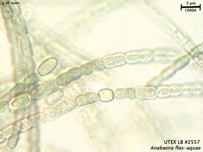 UTEX B 2557 Anabaena flos-aquae | UTEX Culture Collection of Algae