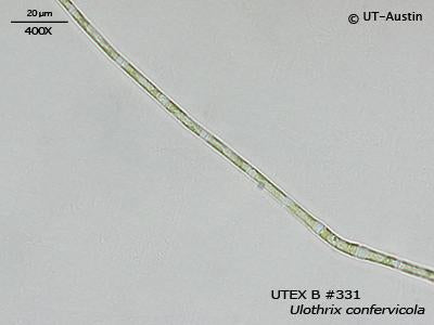 <strong>UTEX B 331</strong> <br><i>Ulothrix confervicola</i>