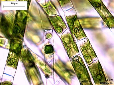 UTEX 420 Ulothrix sp. | UTEX Culture Collection of Algae