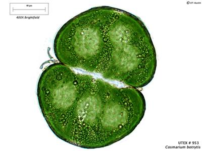 UTEX LB 953 Cosmarium botrytis | UTEX Culture Collection of Algae