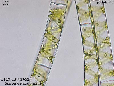 UTEX LB 2462 Spirogyra communis | UTEX Culture Collection of Algae