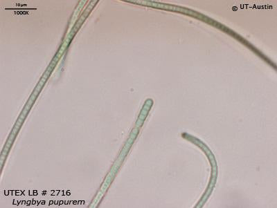 lyngbya under microscope
