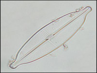 <b>Teaching Kit</b> <br>Diatoms & Symmetry