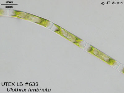 <strong>UTEX LB 638</strong> <br><i>Ulothrix fimbriata</i>