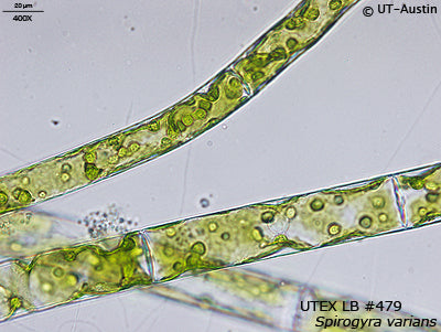 <strong>UTEX LB 479</strong> <br><i>Spirogyra varians</i>