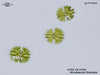 UTEX LB 766 Micrasterias fimbriata | UTEX Culture Collection of Algae