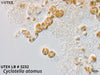 UTEX LB 3232 Cyclotella atomus | UTEX Culture Collection of Algae