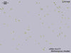 UTEX 1177 Stichococcus chodati | UTEX Culture Collection of Algae