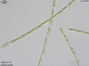 UTEX 1179 Ulothrix belkae | UTEX Culture Collection of Algae