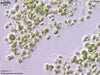 UTEX B 117 Chlorococcum minutum | UTEX Culture Collection of Algae