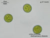 UTEX B 1188 Radiosphaera dissecta | UTEX Culture Collection of Algae