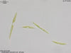 UTEX LB 1381 Closteriopsis acicularis var. africana | UTEX Culture Collection of Algae
