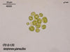 UTEX LB 1392 Astrephomene gubernaculifera | UTEX Culture Collection of Algae
