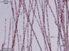 UTEX LB 1505 Acrochaetium sp. | UTEX Culture Collection of Algae
