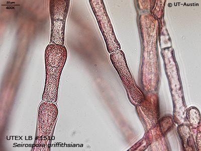 <strong>UTEX LB 1510</strong> <br><i>Seirospora griffithsiana</i>