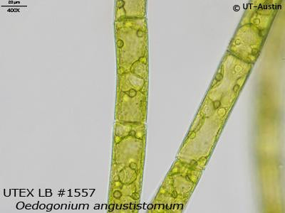 <strong>UTEX LB 1557</strong> <br><i>Oedogonium angustistomum</i>