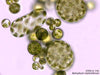 UTEX B 156 Botrydium stoloniferum | UTEX Culture Collection of Algae