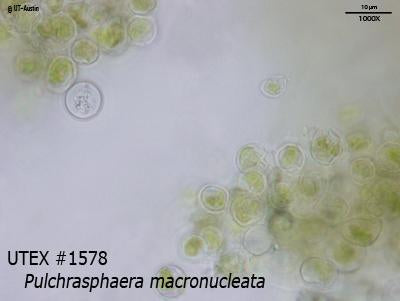 <strong>UTEX 1578</strong> <br><i>Pulchrasphaera macronucleata</i>
