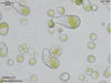 UTEX B 1713 Trebouxia pyriformis | UTEX Culture Collection of Algae