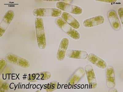 <strong>UTEX 1922</strong> <br><i>Cylindrocystis brebissonii</i>