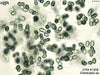 UTEX LB 1938 Gloeocapsa sp. | UTEX Culture Collection of Algae
