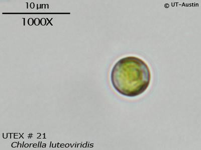 <strong>UTEX B 21</strong> <br><i>Chlorella luteoviridis</i>