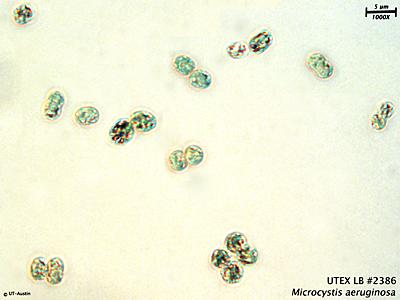 <strong>UTEX LB 2386</strong> <br><i>Microcystis aeruginosa</i>
