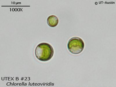 <strong>UTEX B 23</strong> <br><i>Chlorella luteoviridis</i>