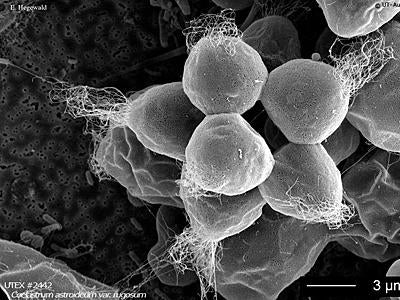 Coelastrum Microalgae UTEX B 2442 Coelastrum astroideum var. rugosum | UTEX Culture ...