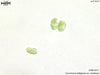 UTEX B 271 Coccomyxa peltigerae var. variolosae | UTEX Culture Collection of Algae