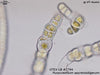 UTEX LB 2794 Purpureofilum apyrenoidigerum | UTEX Culture Collection of Algae