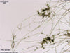 UTEX LB 2801 Batrachospermum intortum | UTEX Culture Collection of Algae