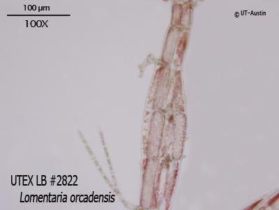 UTEX LB 2822 Lomentaria orcadensis | UTEX Culture Collection of Algae