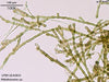 UTEX LB 2833 Ptilothamnion sp. | UTEX Culture Collection of Algae