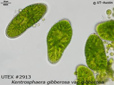<strong>UTEX 2913</strong> <br><i>Kentrosphaera gibberosa var. gibberosa</i>