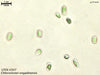 UTEX B 307 Chlorocloster engadinensis | UTEX Culture Collection of Algae