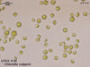 UTEX 30 Chlorella vulgaris | UTEX Culture Collection of Algae