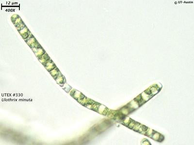 Ulothrix Under Microscope