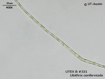 Utothrix UTEX B 331 Ulothrix confervicola | UTEX Culture Collection of Algae