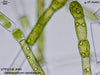 UTEX LB 40 Oedogonium cardiacum | UTEX Culture Collection of Algae