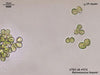 UTEX LB 572 Botryococcus braunii | UTEX Culture Collection of Algae