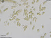 UTEX B 750 Ankistrodesmus braunii | UTEX Culture Collection of Algae