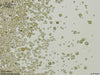UTEX B 894 Trebouxia glomerata | UTEX Culture Collection of Algae