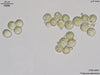 UTEX 895 Trebouxia glomerata | UTEX Culture Collection of Algae