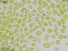 UTEX B 962 Desmotetra stigmatica | UTEX Culture Collection of Algae