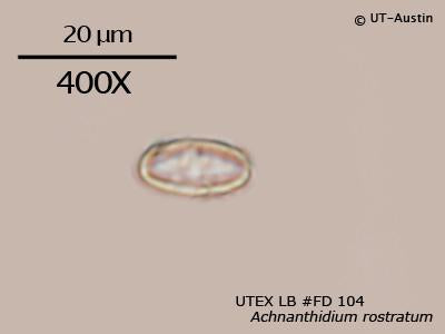 <strong>UTEX LB FD104</strong> <br><i>Achnanthidium rostratum</i>
